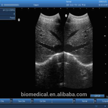 Economic Functional Portable 3D Ultrasound Scanern Machine Price For Abdominal Organ Illness Diagnoses