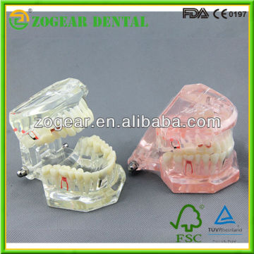 Dental Model for Medical Education, teeth model