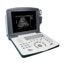 Scanner d&#39;échographie noire et blanc portable pour l&#39;urologie