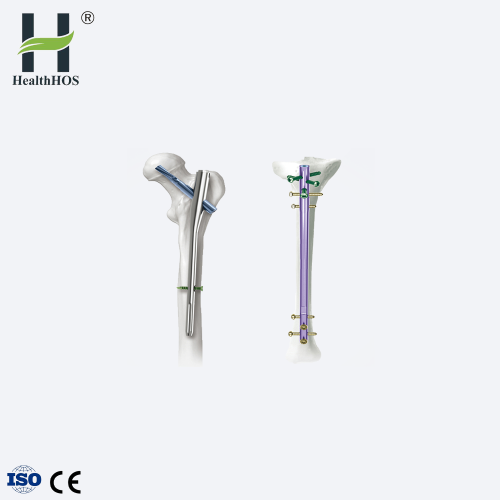 Orthopaedic femur interlocking intramedullary nail PFNA nail