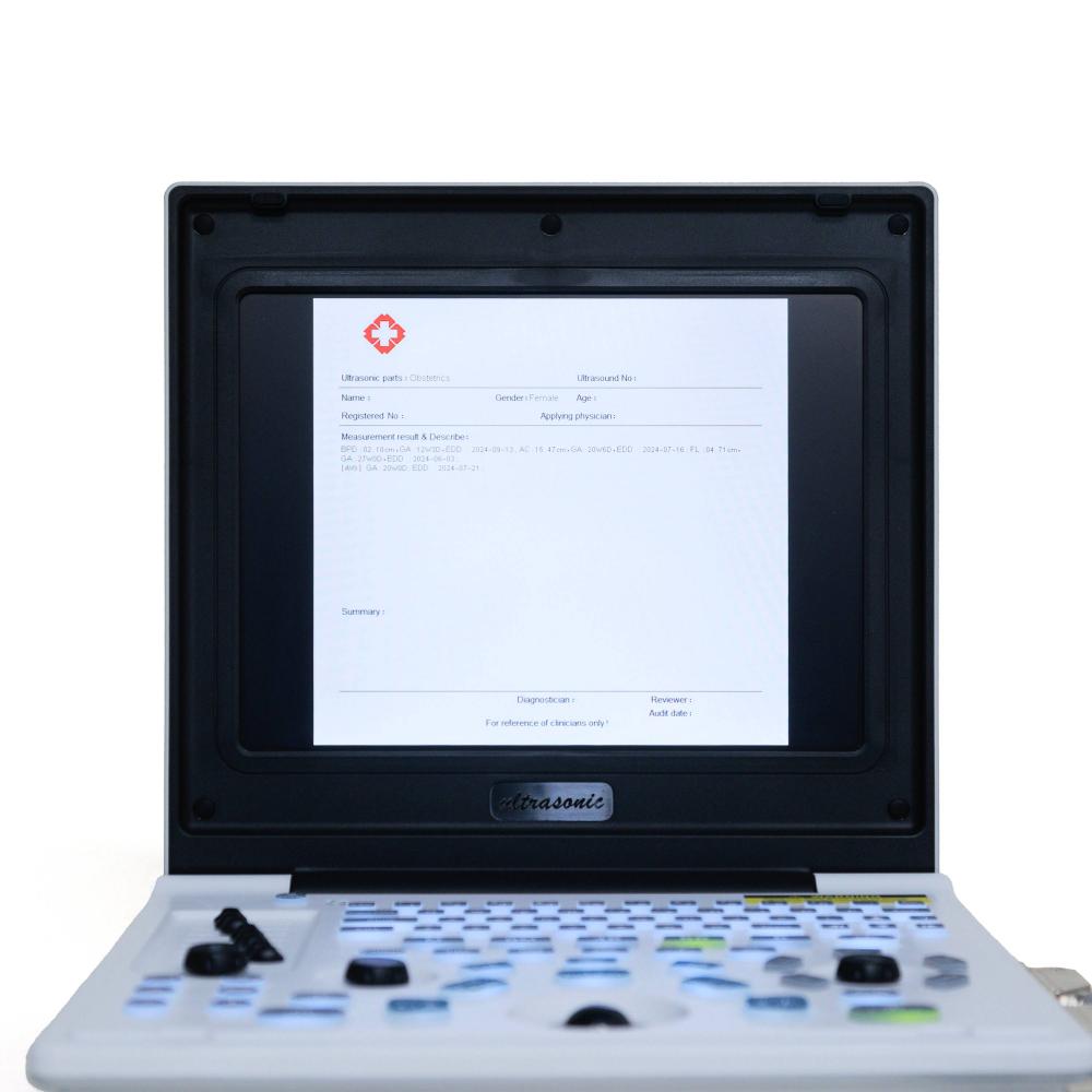 Ультрагукавы экран ноўтбука 9 Laptop Ultrasound Screen 9