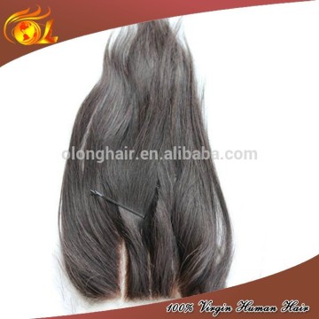 Three Part Natural Hairline Brazilian Virgin Hair Lace Closures