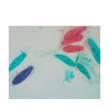Parasitic Protozoa Microscope Slides: Paramecium Caudatum and More