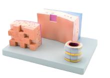 Gas wall dissection model