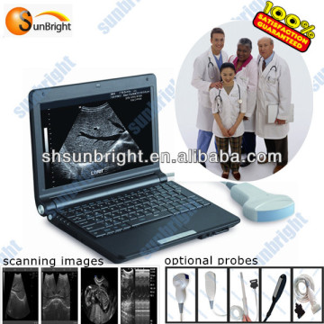 ultrasound scan probe