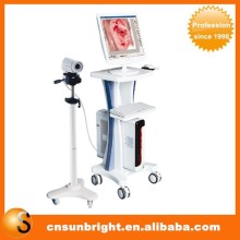 beautiful vagina colposcope ccd camera colposcope