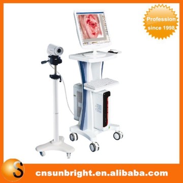 beautiful vagina colposcope ccd camera colposcope