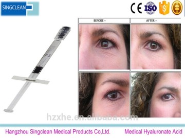 hot sale smooth high quality CE Hyaluronic Acid sodium hyaluronate Viscoelastic Solution