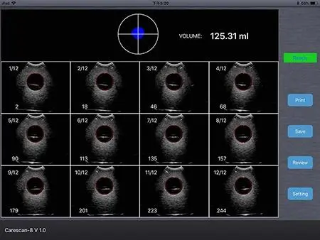 New Brand 4D Wireless Ultrasound for Hospital or Clinic