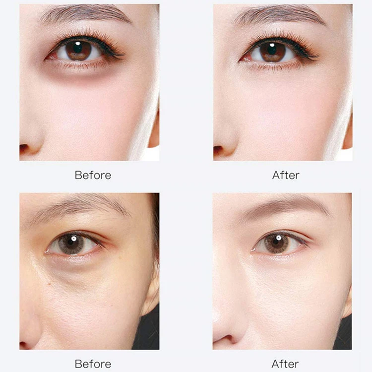 Advanced Collagen Under Eye Gel Pads Hyaluronic Acid Anti-Aging Under Eye Mask