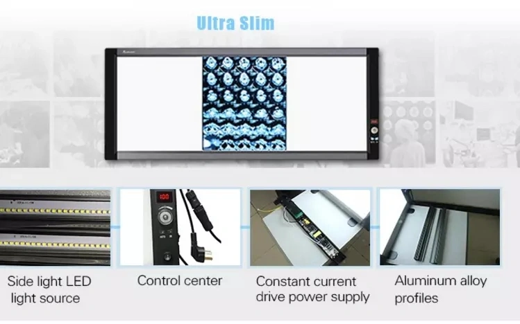 Ultra Slim LED 2 Bank LED Dental Negatoscope Medical X Ray Film Viewer with CE with ISO13485