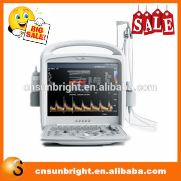 color doppler Vascular ultrasound machine / portable vascular doppler