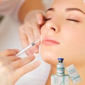 Plla fills for wrinkles around eyes for anti aging