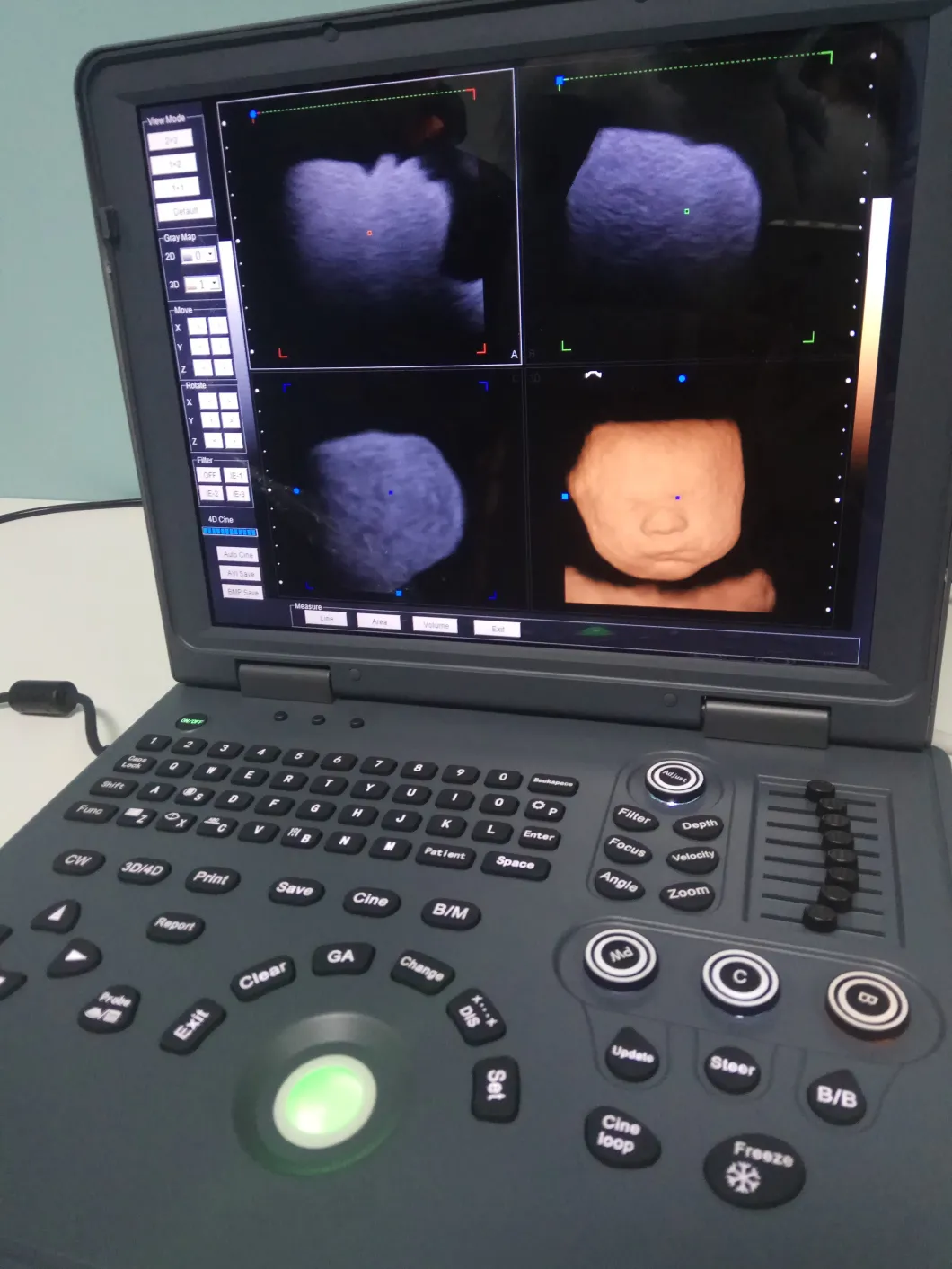 Upgraded Version Laptop Color Doppler Ultrasound Machine