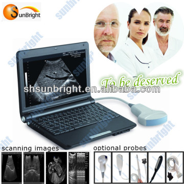 China Ultrasound cart