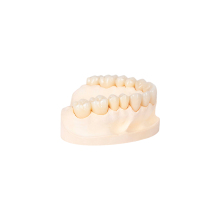 Multilayerd Full Zirconia Dental Restoration