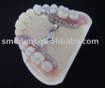 Dental magnetic attachment/Ball system attachment