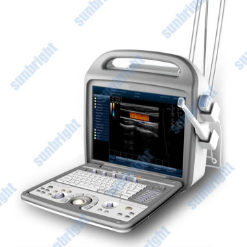 Doppler Ultrasound Equipment Type fetal doppler