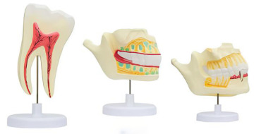The permanent tooth arrangement model of deciduous teeth