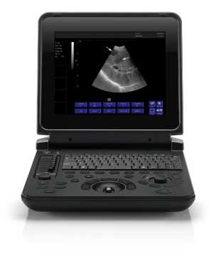 Digital Laptop Ultrasound Diagnostic System for Veterinary