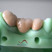 3D Printing Model PFM COCR Bridge