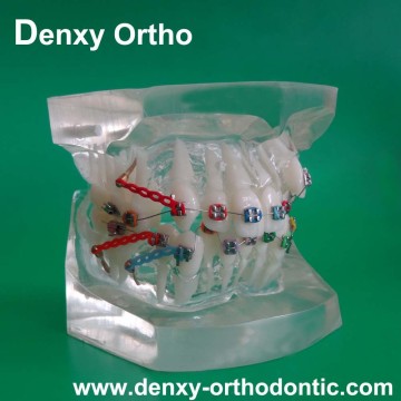 orthodontic materials fashion dental orthodontic study model