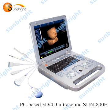 4D Ultrasound with CE/ISO certificate/4D laptop PC-based ultrasound