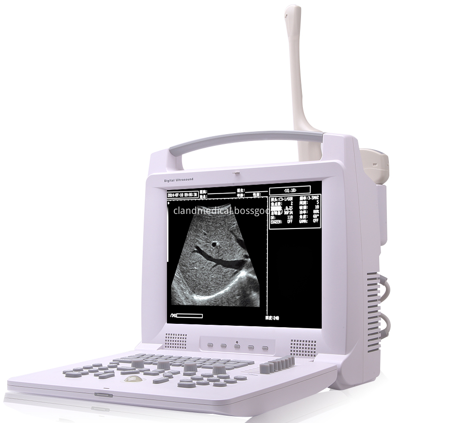 Escáner de ultrasonido portátil Pl 3018i Full Digital 18 Pl 3018i Full Digital Portable Ultrasound Scanner 18