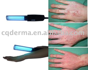 Eczema therapy lamps- Psoriasis, Vitiligo, Eczema, Atopic Dermatitis