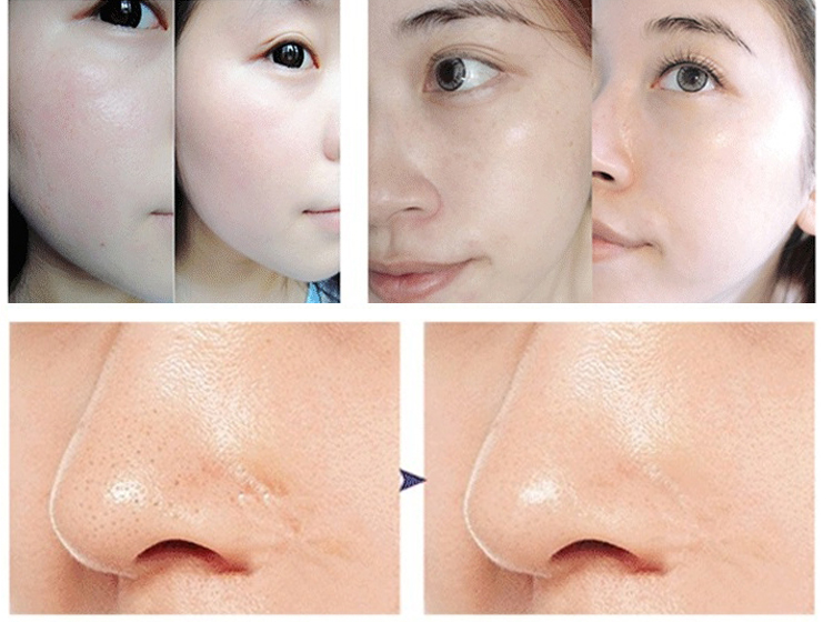 Skin rejuvenation beauty machine 7 color  led light multi-function LED beauty mask