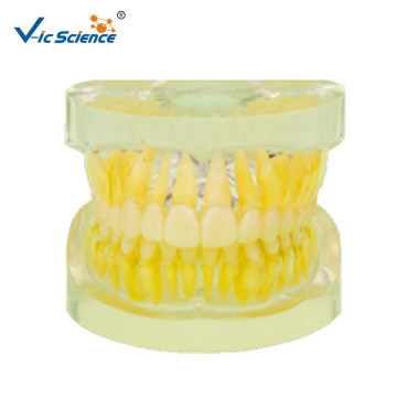 Dental Removable Standard Model