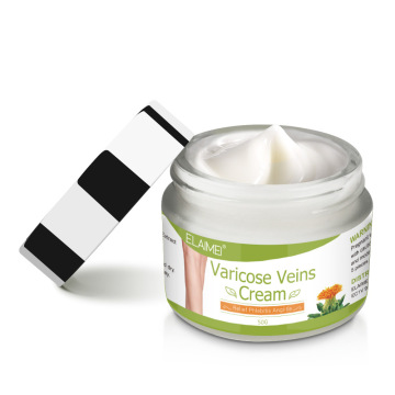Natural Varicose Vein Repair Cream: Relief for Venous Pain and Leg Fatigue - Body Care Products