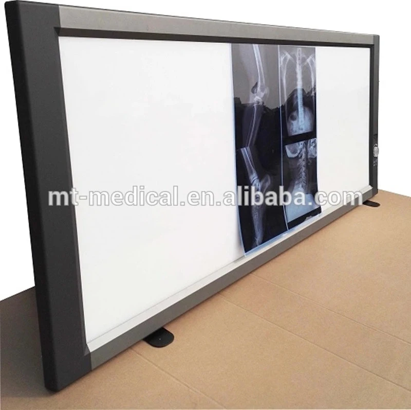 Medical LED X Ray Film Illuminator Film Viewer for Hospital