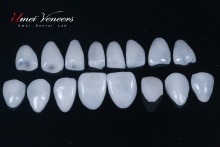 Strong zirconia dental veneers