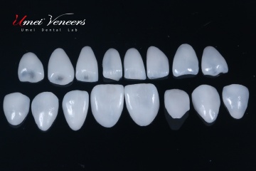 Strong zirconia dental veneers