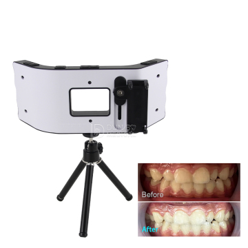 Oral Filling Lamp Mobile Dental Flash Light