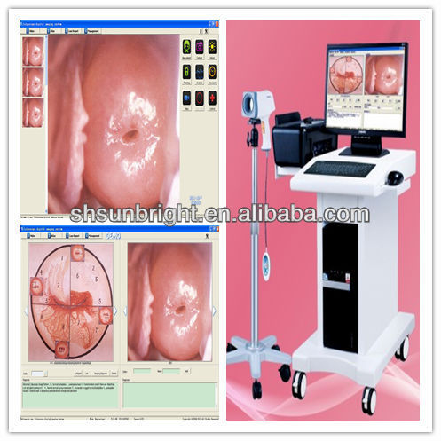 Portable Digital Colposcope image forming system