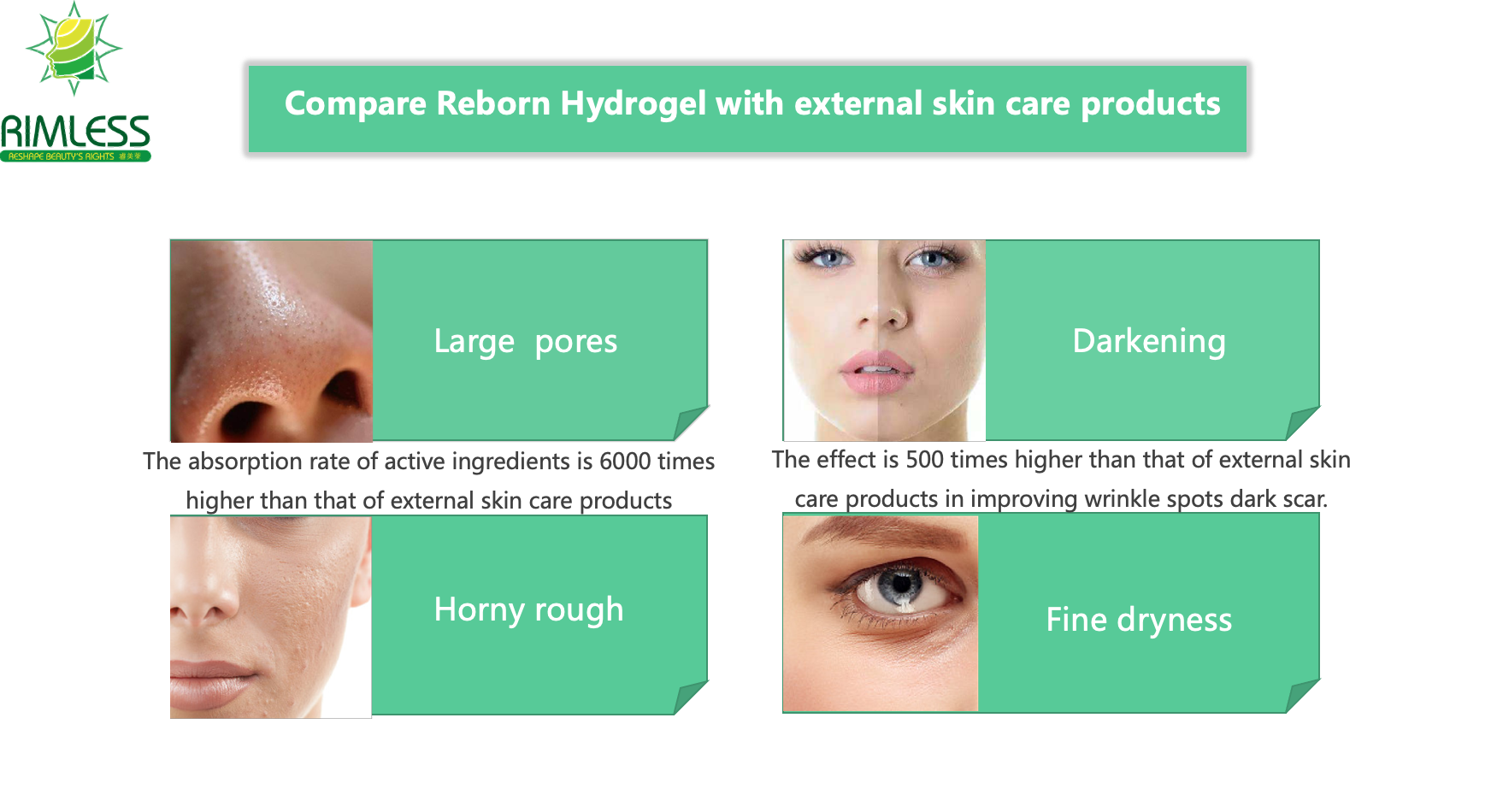 Reborn PLLA Hydrogel para remover rugas do rosto/rugas do pescoço