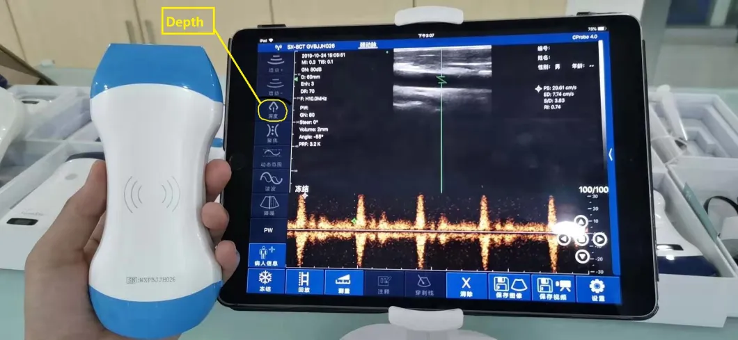 Medical Equipment Wireless Color Doppler Ultrasound Scanner WiFi Probe Convex Linear Handheld Ultrasound