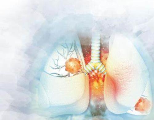 Cyclohexanecarboxylic एसिड, 4- (4-क्लोरो-6-मिथाइल-2-पाइरीमिडिनिल) -1-मेथॉक्सी-, मिथाइल एस्टर प्रालसेटिनिब कैस 2097133-31-6 के लिए