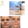 Filloup Pcl Water Light skinbooster Regenerate Collagen Fibers