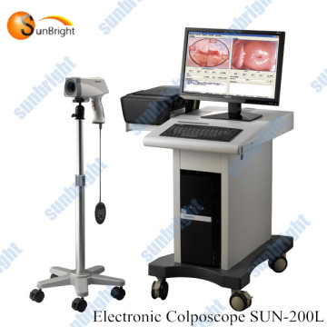 Russian software video colposcope