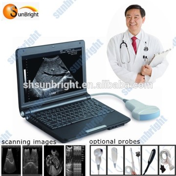 cardiac color ultrasound scanner