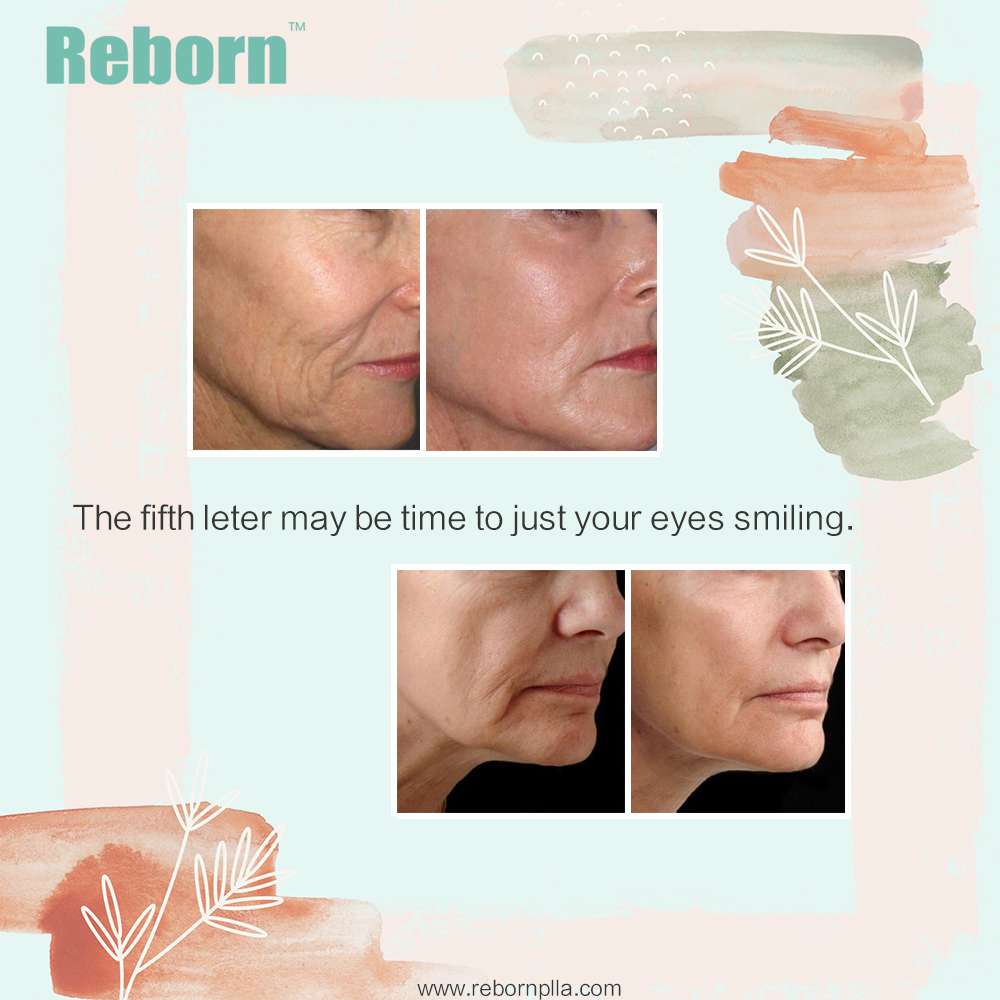 Reborn filler make youthful look