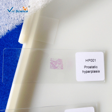 Standared Medical Pathology Microscope Slides