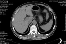 Inkjet ink for medical image
