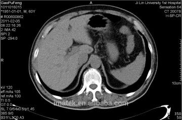 Inkjet ink for medical image