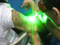 Nd yag laser voor tatoeage verwijdering machine