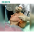 Reborn aesthetic plla dermal filler