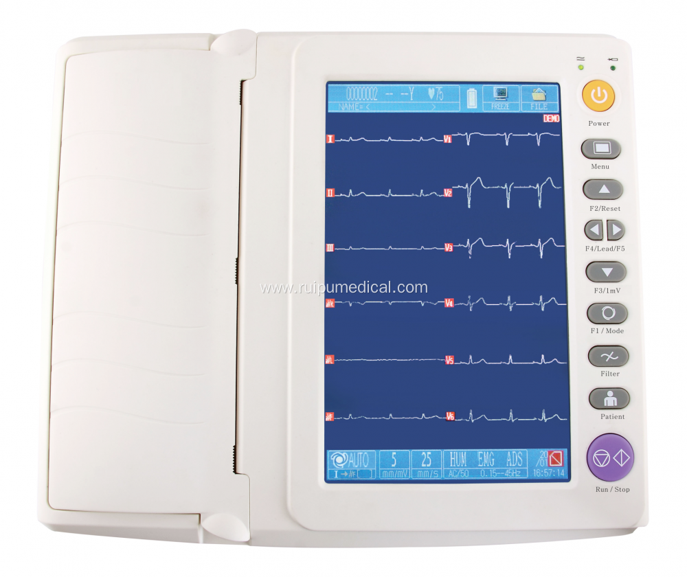 CE Intelligent 12 Channel ECG Machine Electrocardiograph